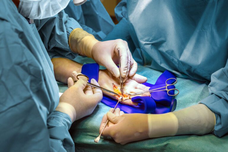 Dit beeld toont een chirurgische ingreep waarbij medisch personeel, gehuld in steriele chirurgische kleding, bezig is met een operatie aan de hand van een patiënt. De zorgvuldige precisie en concentratie van de teamleden maken duidelijk dat elk detail van cruciaal belang is. De blauwe doeken en handschoenen domineren de scène, wat bijdraagt aan de klinische sfeer. Foto door Jan Buwalda, Groningen.